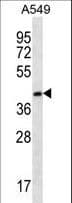 IHC-plus™ FBLIM1 / Migfilin Antibody (aa294-323)