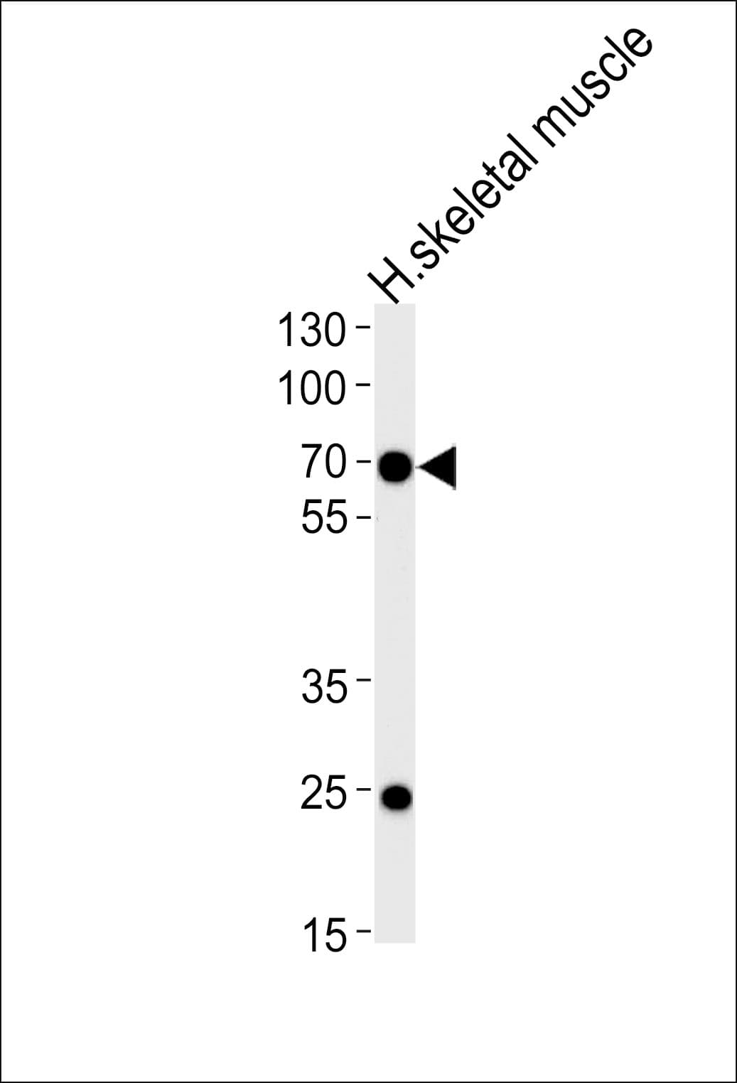 FAM198B / C4orf18 Antibody (aa275-304)