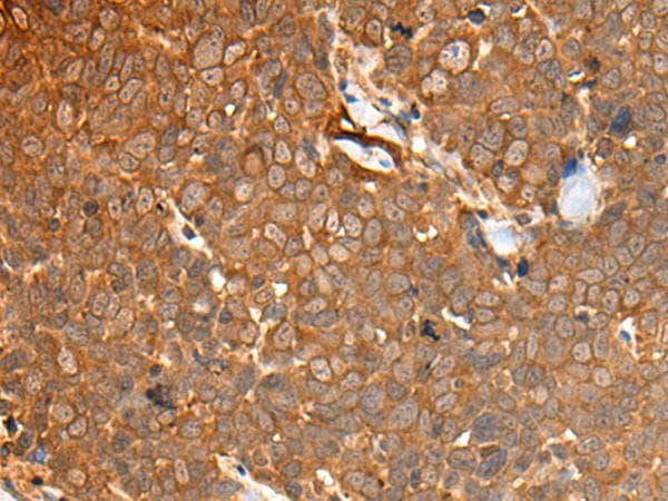 CAD Antibody