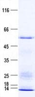 Human CEP55 Protein (Recombinant His, N-Terminal)