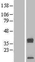 TRAM2 Protein (Over-Expression Lysate Myc-DDK (Flag))