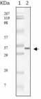 SARS-CoV M Protein Antibody (clone 2H2C4)