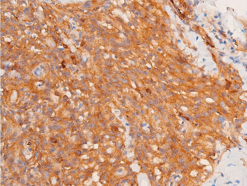 Polyclonal Rabbit anti-Human CHEK1 / CHK1 Antibody (phospho-Ser317, IHC, IF, WB)
