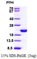 Human HPCAL1 / Hippocalcin-Like 1 Protein (Recombinant His)