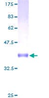 Human CNIH3 Protein (Recombinant GST)