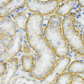 Polyclonal Rabbit anti-Human ARFGAP1 Antibody (IHC, IF, WB)