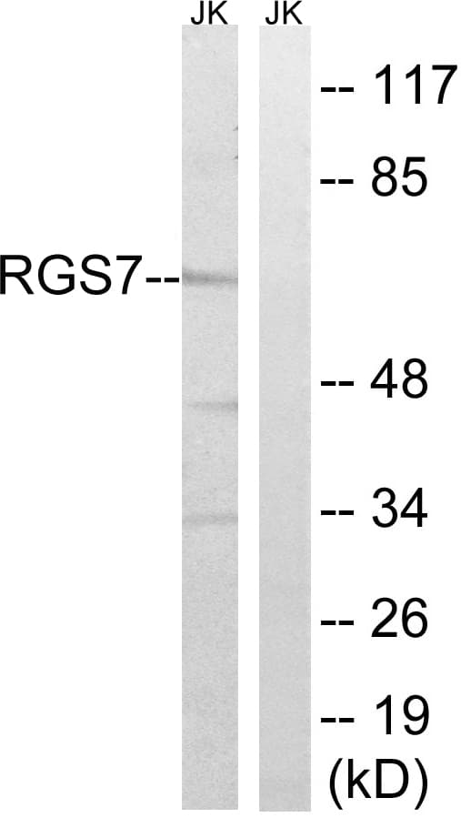 RGS7 Antibody (aa155-204)