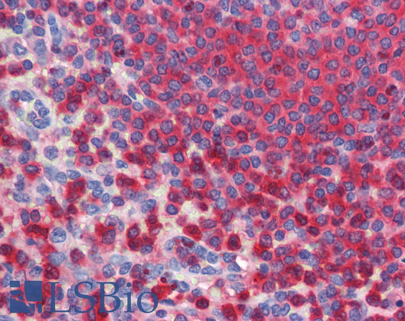 IHC-plus™ Monoclonal Mouse anti-Human G6PD Antibody (clone AT2F6, IHC, WB)