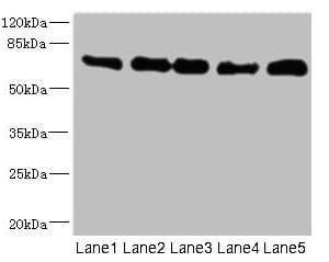 Polyclonal Rabbit anti-Human NUMB Antibody (WB)