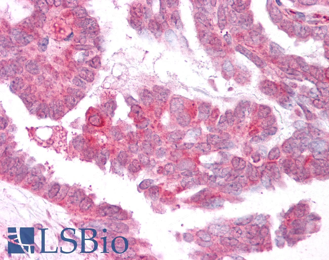 IHC-plus™ TRPM4 Antibody (C-Terminus)