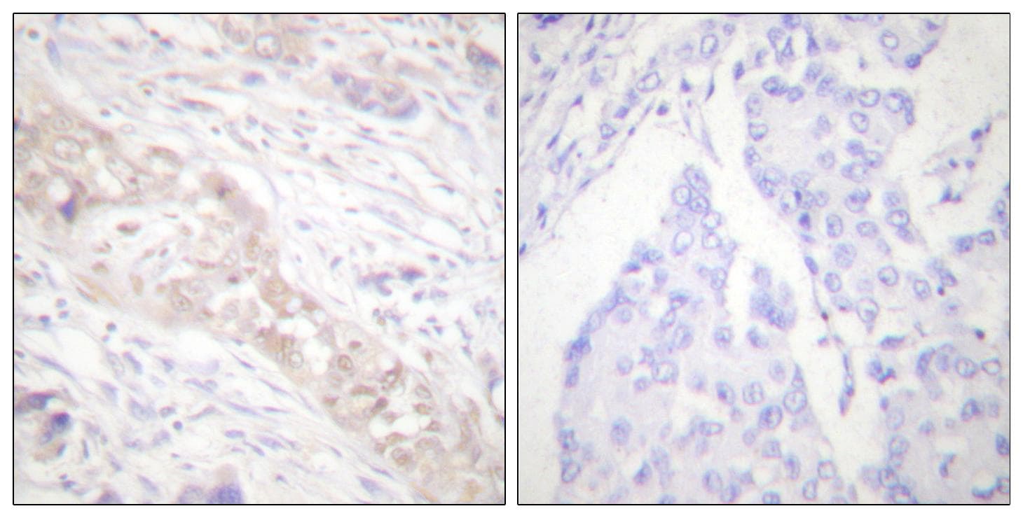 Polyclonal Rabbit anti-Human SMAD2 Antibody (phospho-Ser467, IHC, WB)