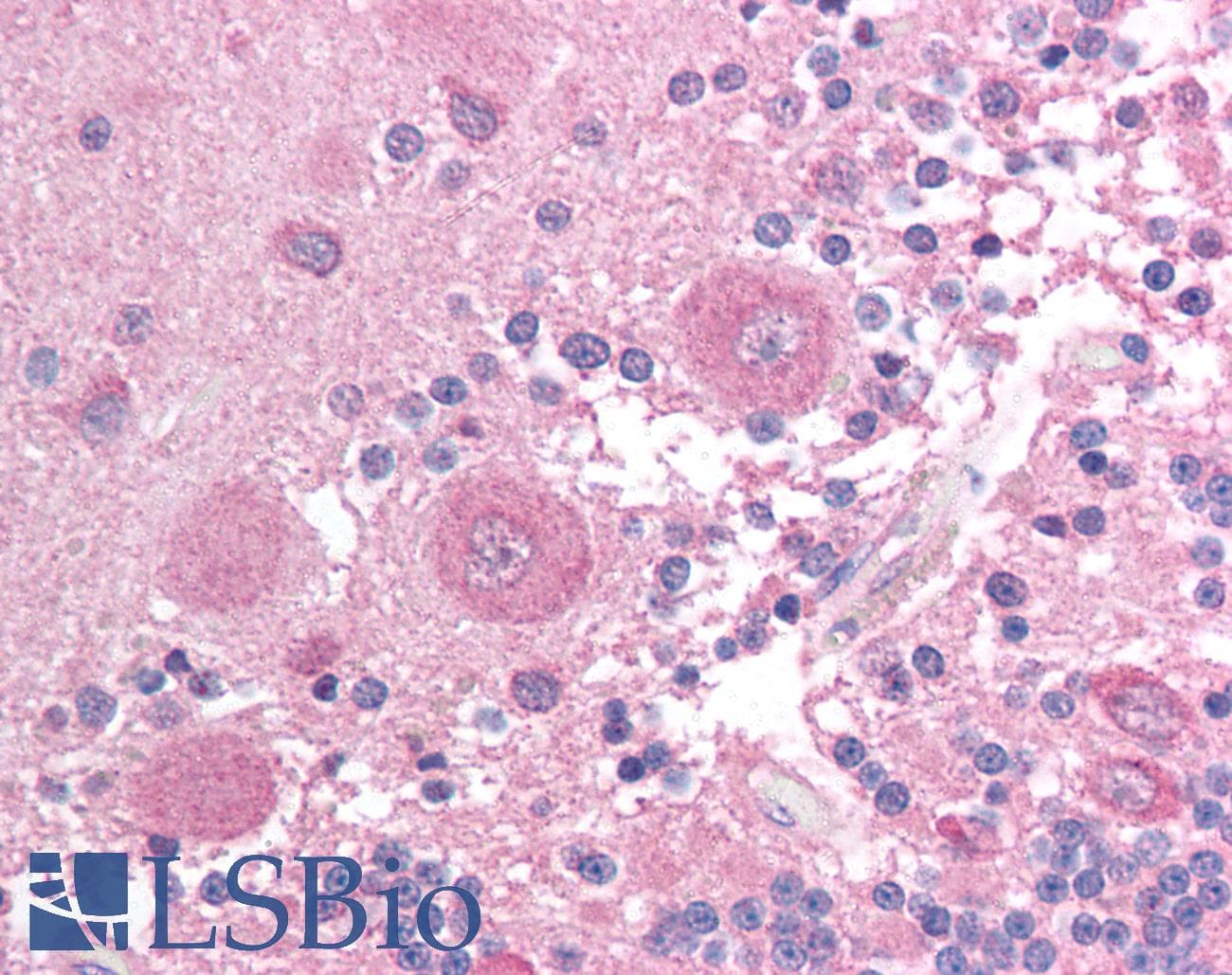 IHC-plus™ BCL2L14 / BCL-G Antibody