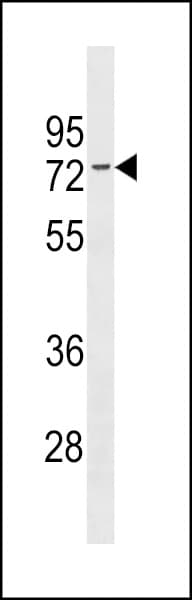 Polyclonal Rabbit anti-Human ER Alpha / Estrogen Receptor Antibody (aa130-157, WB)