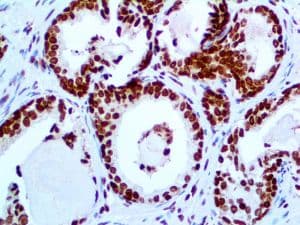 RABEPK / p40 Antibody (clone ZR8, Ready-to-Use)
