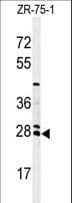 Polyclonal Rabbit anti-Human TSC501 / NAT8 Antibody (aa110-138, IHC, WB)