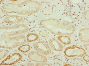 TWIST2 Antibody