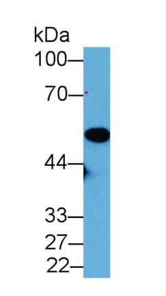 ENO1 / Alpha Enolase Antibody (PE)