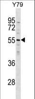 ZNF620 Antibody (aa73-102)