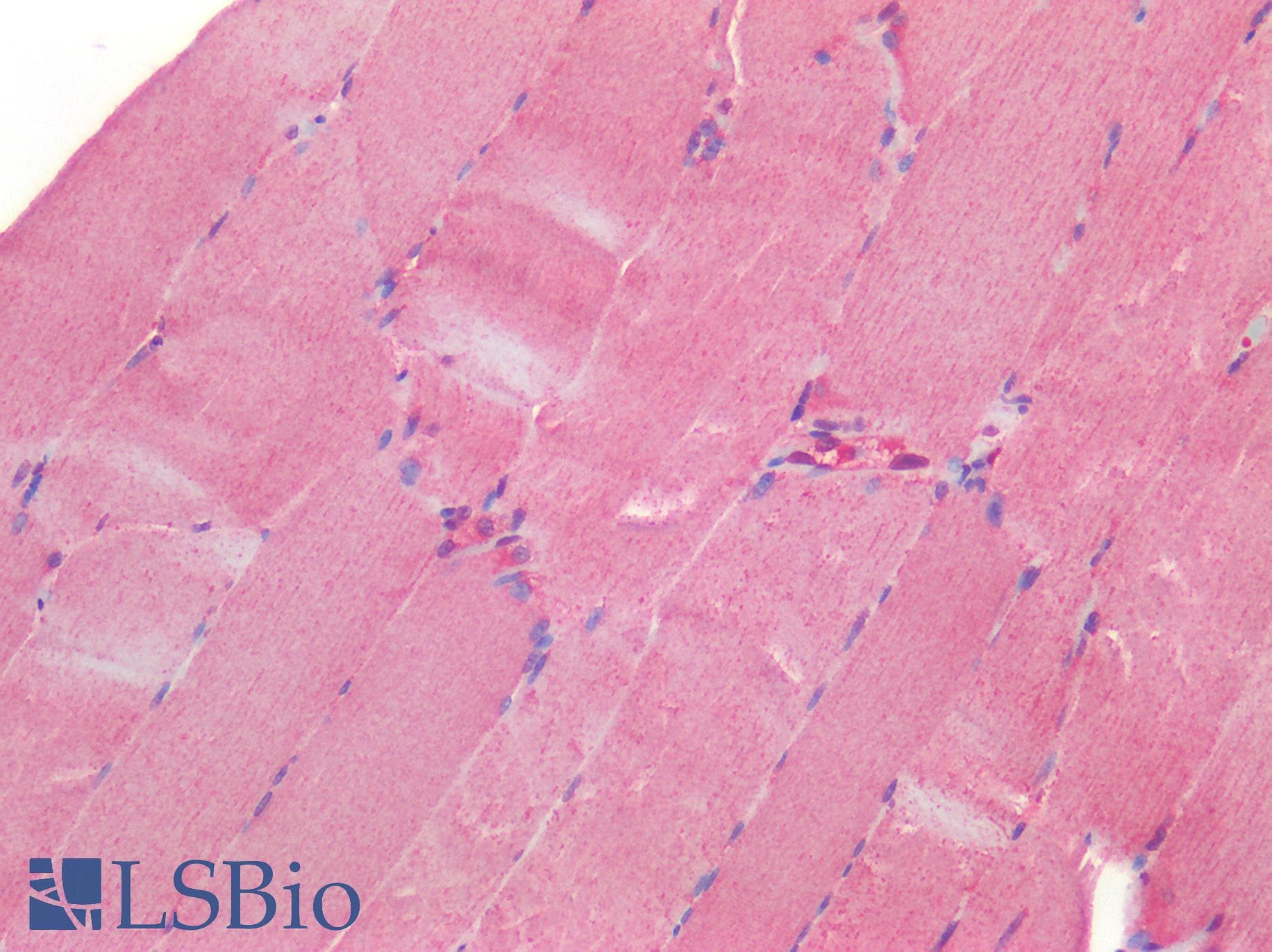 IHC-plus™ Polyclonal Rabbit anti-Human ROR1 Antibody (C-terminal, IHC)