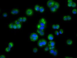 ACAT2 Antibody (clone OTI3C9)