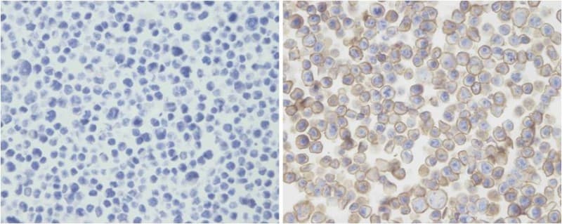 PD-L2 / PDCD1LG2 / CD273 Antibody (N-Terminus, clone 2011CT265.19.18)