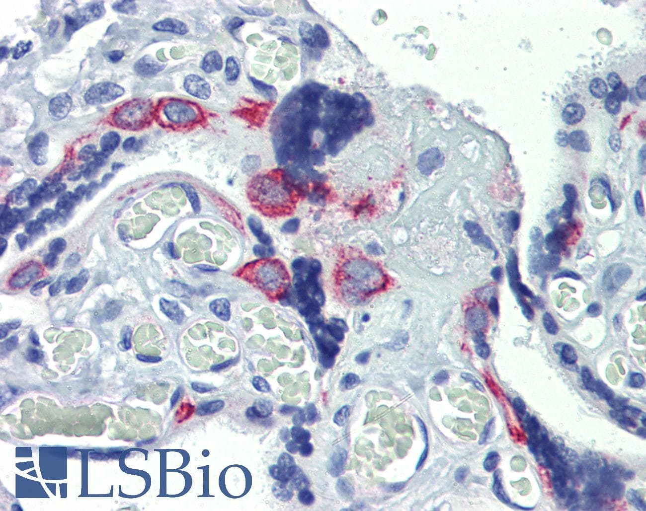 Polyclonal Rabbit anti-Human ZNF71 Antibody (C-Terminus, IHC, WB)