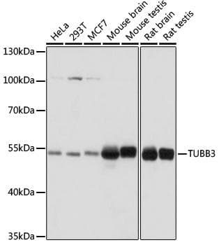 TUBB3 / Tubulin Beta 3 Antibody