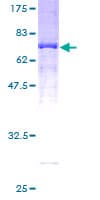 Human Alpha-1-Antichymotrypsin Protein (Recombinant GST)