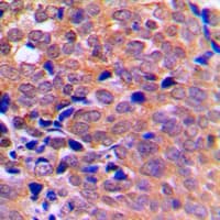 PRKAA1 + PRKAA2 Antibody (Internal)