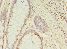 GCC1 / GCC88 Antibody