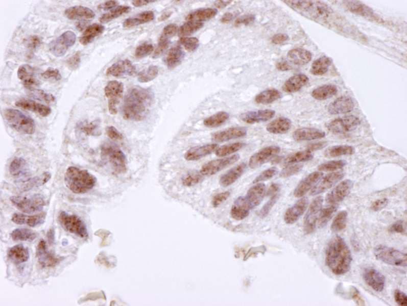 CTCF Antibody (aa650-700)
