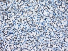 Monoclonal Mouse anti-Human BRAF / B-Raf Antibody (clone OTI4G6, IHC, WB)