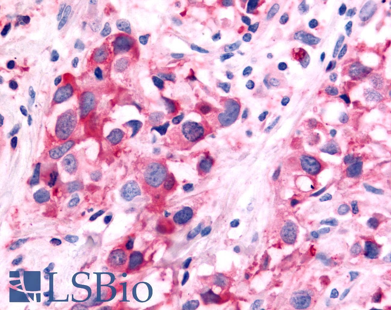 PathPlus™ NR5A2 / LRH-1 Antibody (Internal)