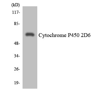 Polyclonal Rabbit anti-Human CYP2D6 Antibody (aa303-352, WB)