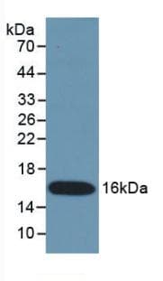IFN Gamma / Interferon Gamma Antibody (FITC)