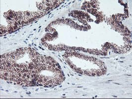 PPP1R15A / GADD34 Antibody (clone OTI3D12)
