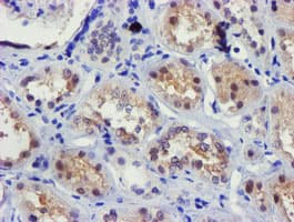 FBXO21 Antibody (clone OTI2B8)