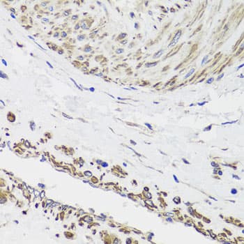 DES / Desmin Antibody