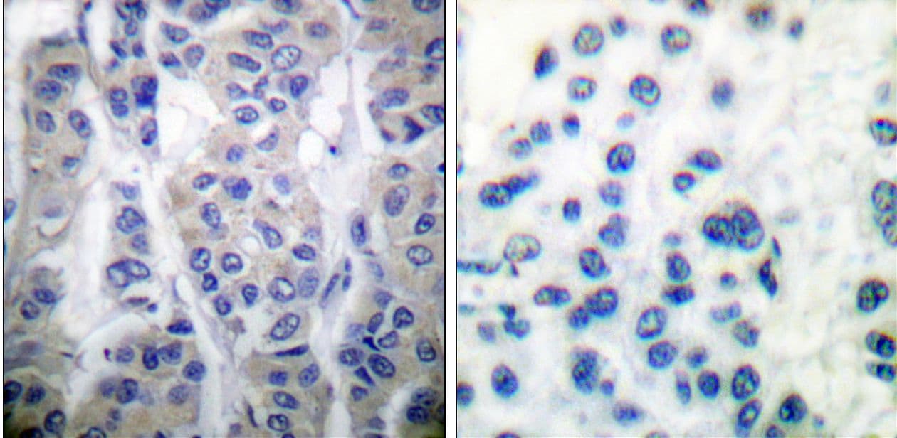 LIMK1 / LIMK Antibody (phospho-Thr508/505)
