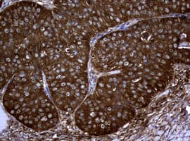 NME1 / NM23 Antibody (clone OTI2A5)