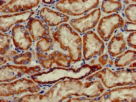 Polyclonal Rabbit anti-Human HAO2 Antibody (IHC, WB)