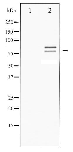 LIPE / HSL Antibody (phospho-Ser855/554)