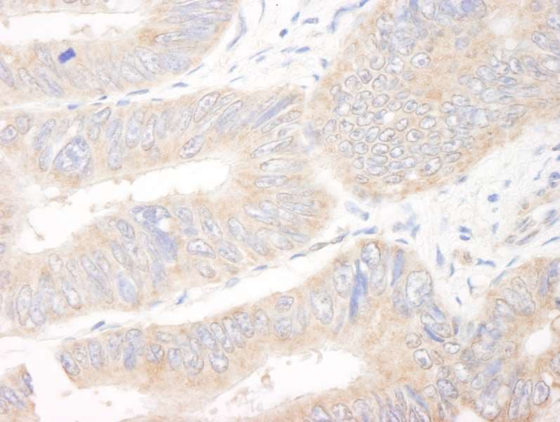 KIAA1524 / p90 Autoantigen Antibody (aa853-903)