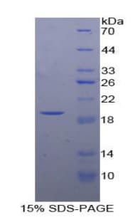 Bovine IGFBP3 Protein (Recombinant His-T7)