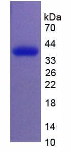 Human PV1 / PLVAP Protein (Recombinant His-T7)