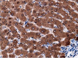 EPHX2 / Epoxide Hydrolase 2 Antibody (clone OTI1H5)