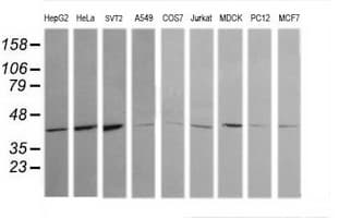 MAPK13 / p38delta Antibody (clone OTI2G1)