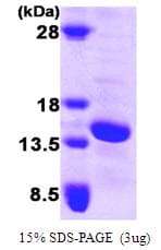 Human E-FABP / FABP5 Protein (Recombinant)