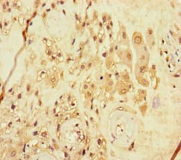 Polyclonal Rabbit anti-Human ARHGEF5 Antibody (IHC)