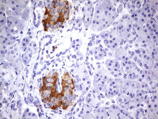 BFSP2 Antibody (aa184-415, clone OTI1C2, Carrier-free)